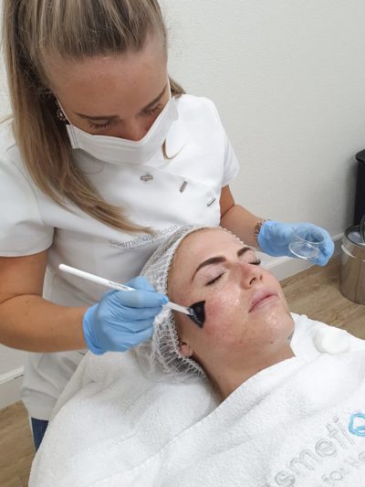 Ervaring Peeling