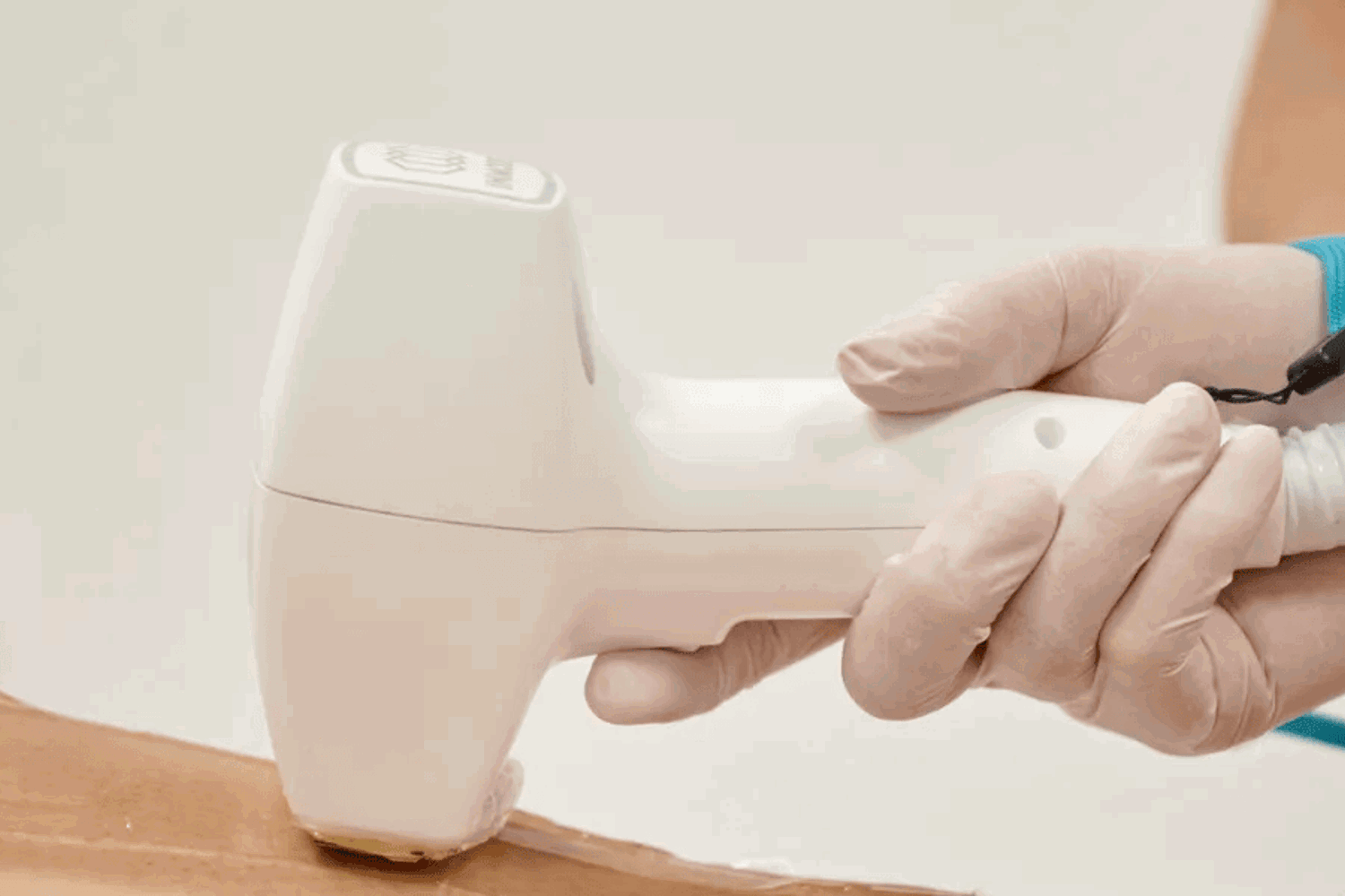 Laser Haarentfernung Der Gesassfalte