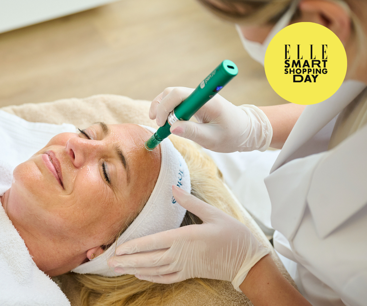 Microneedling + vitamine C peeling