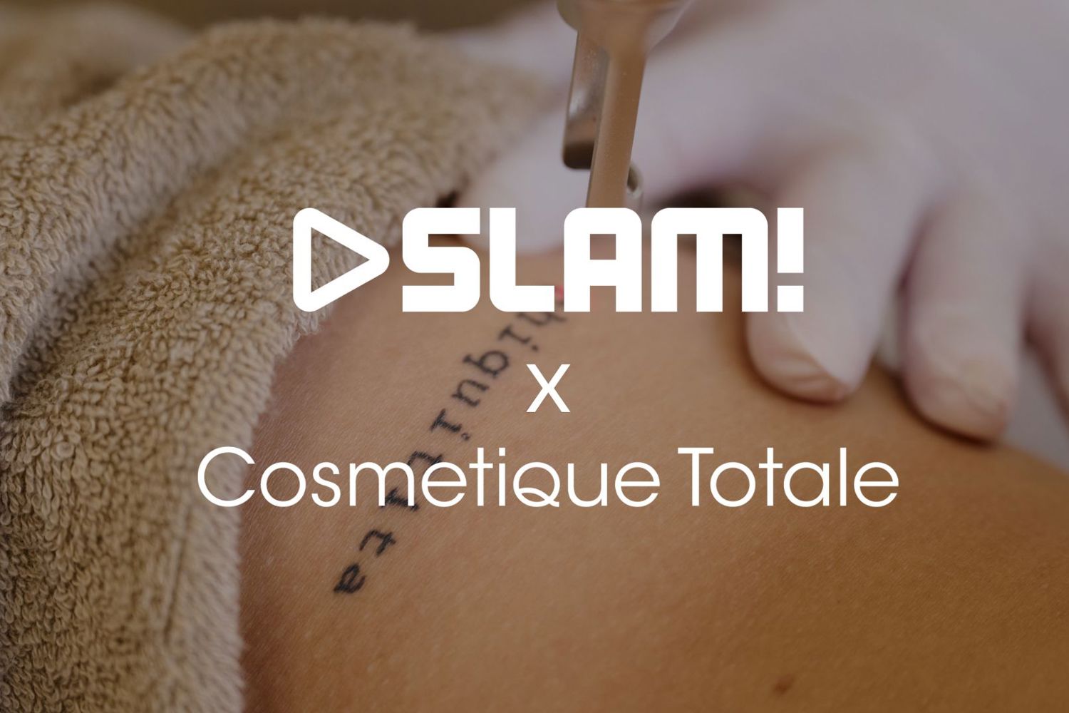 SLAM tattoo laseren actie