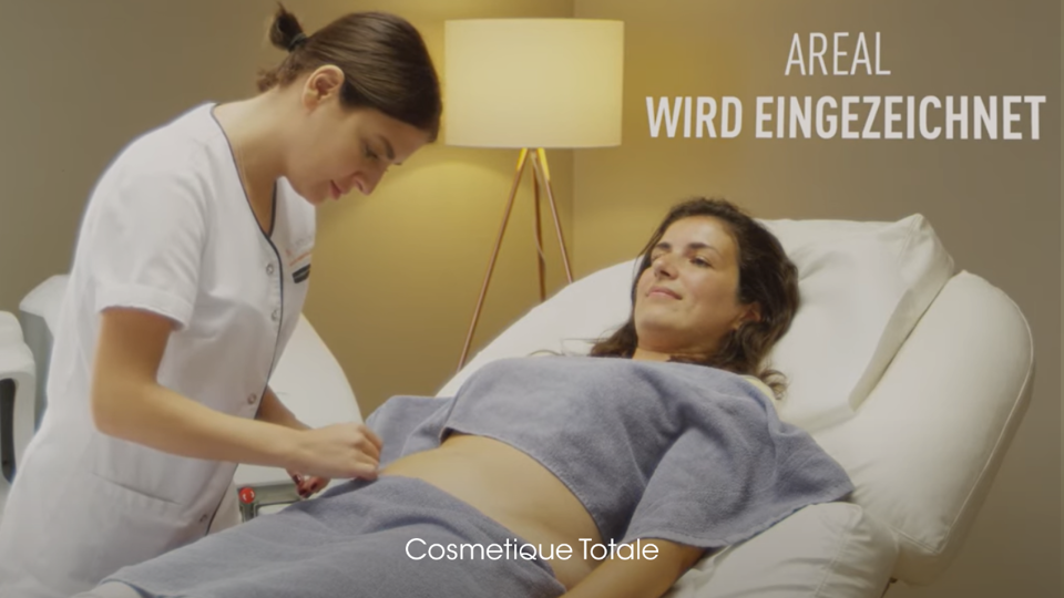 Kryolipolyse Behandlung Myderma