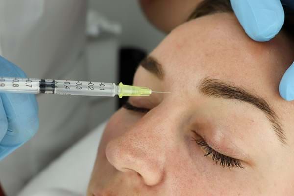 Botox Behandeling Fronsrimpel (1)
