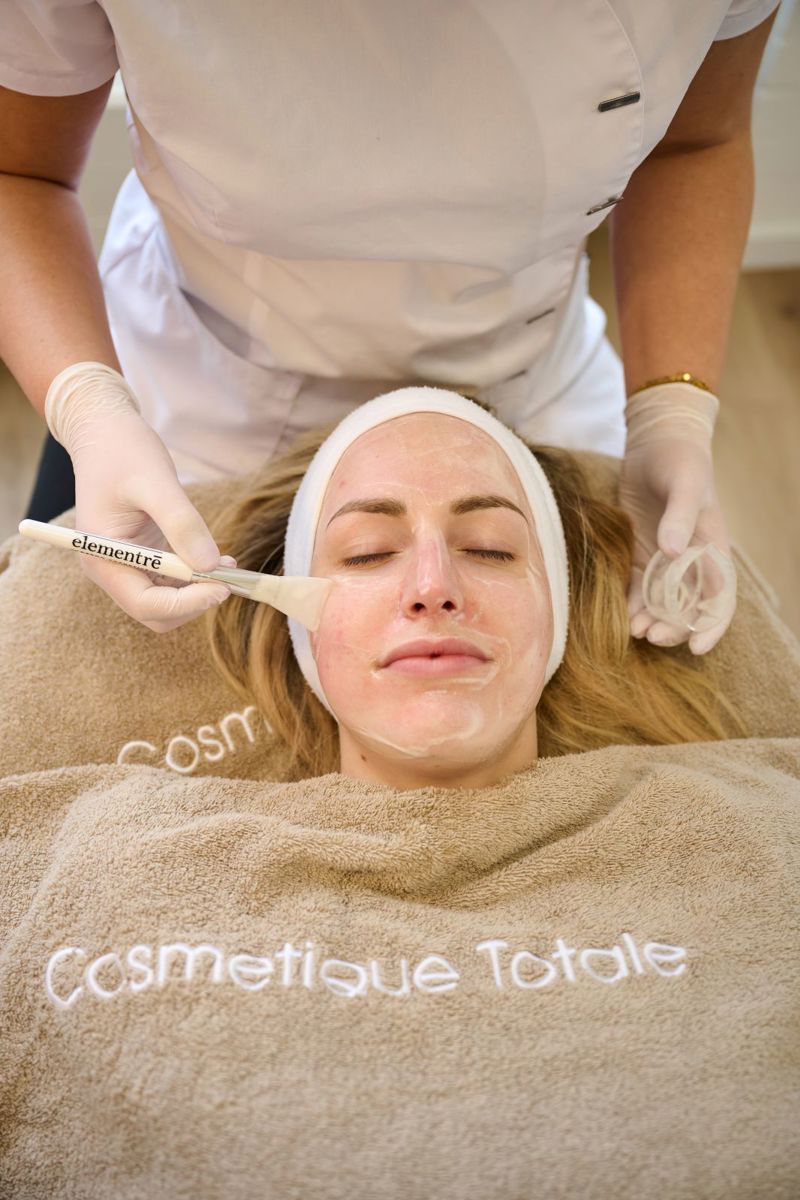Huidtherapeut behandelt de huid tijdens een microneedling- en acnebehandeling