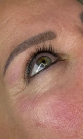 Total Eye Result 6 After