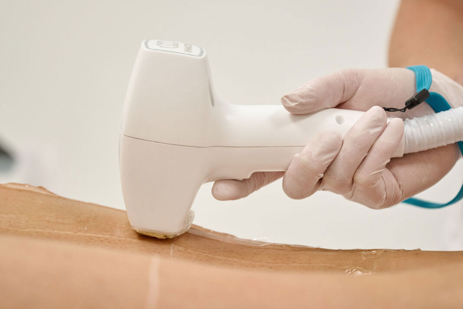 Préparation Et Précautions Avant Une Séance Epilation Lumiere Pulsee