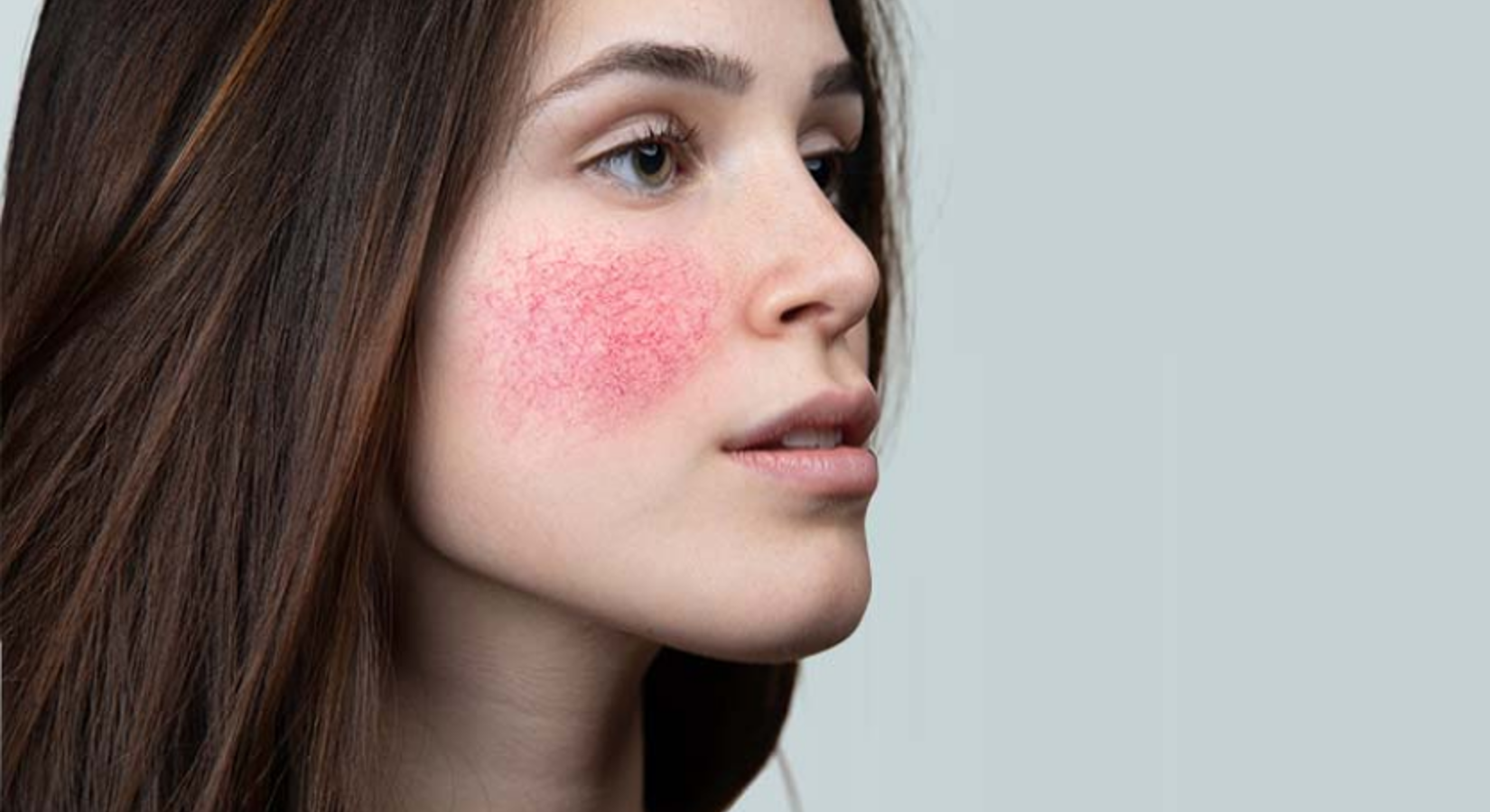 6 Faits Et Fables Sur Les Rougeurs Du Visage