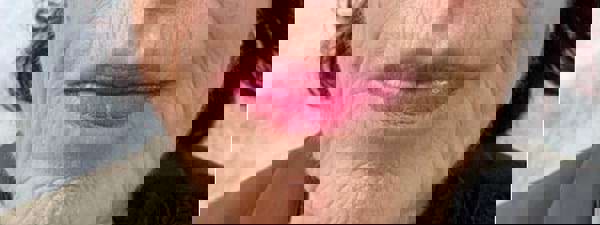 Ergebnis Nach 3 Behandlungen