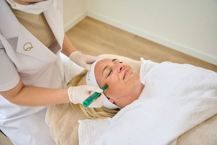 Microneedling Heemstede