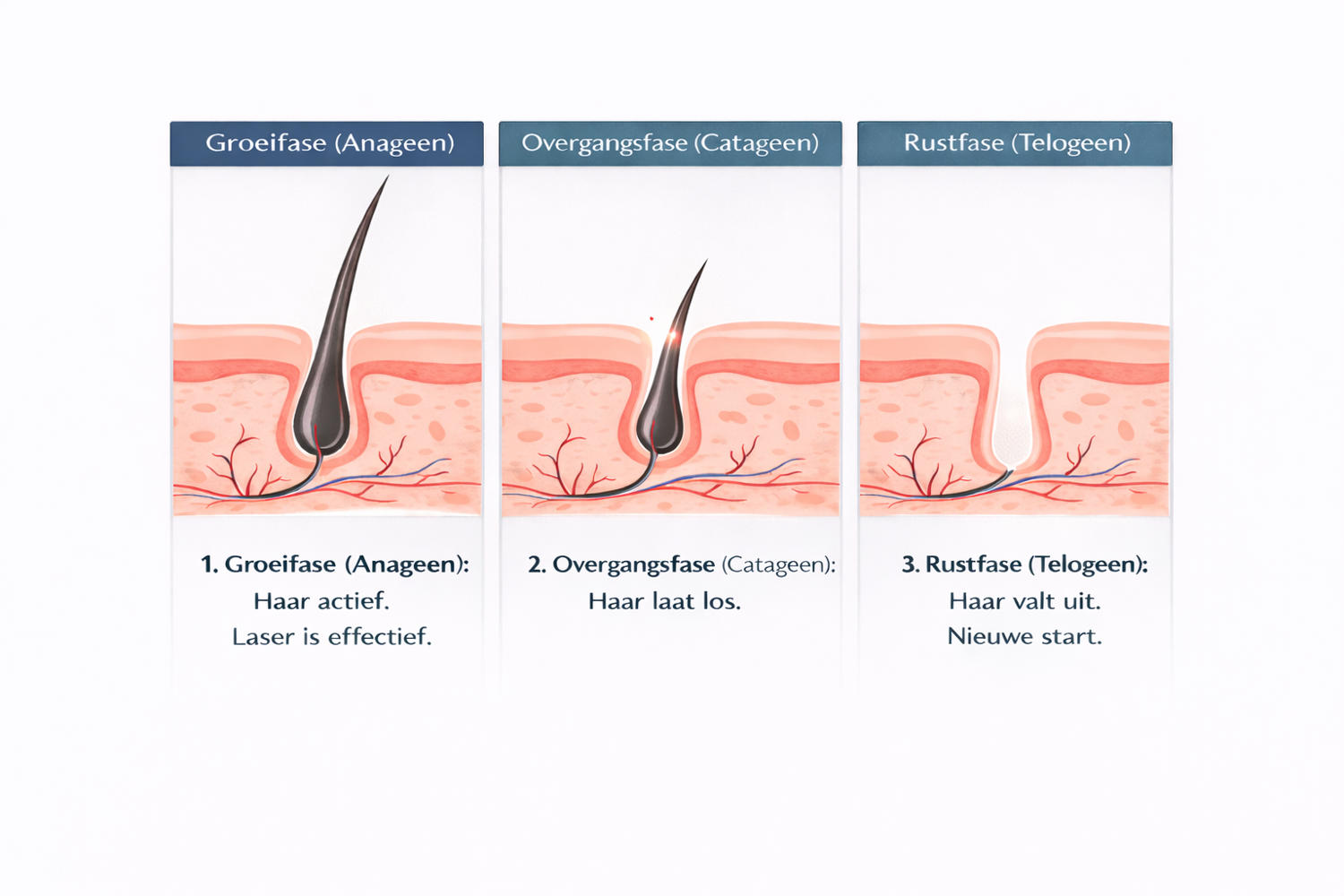 Haargroeicyclus Laser Ontharen Oplossing