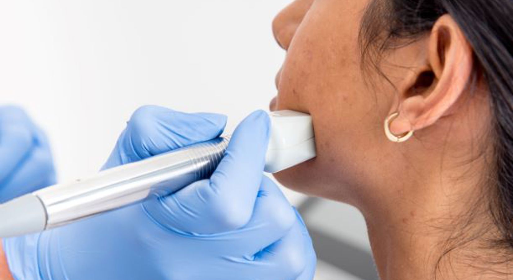 Header Acne Littekens Wat Zijn Het En Hoe Kom Ik Er Vanaf