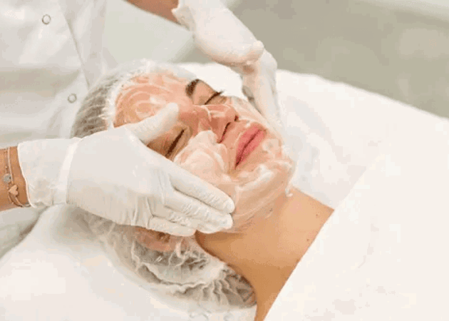 Medische Peelings