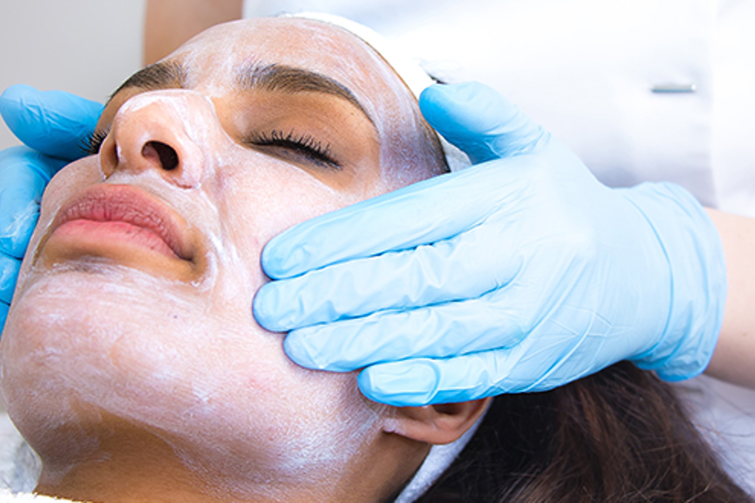 Traitement De L'acné Par Peeling (1)