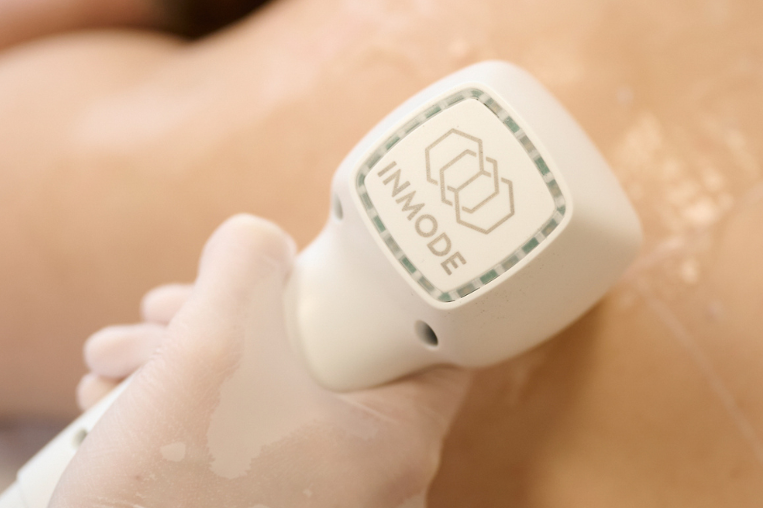 Epilation Laser Inmode