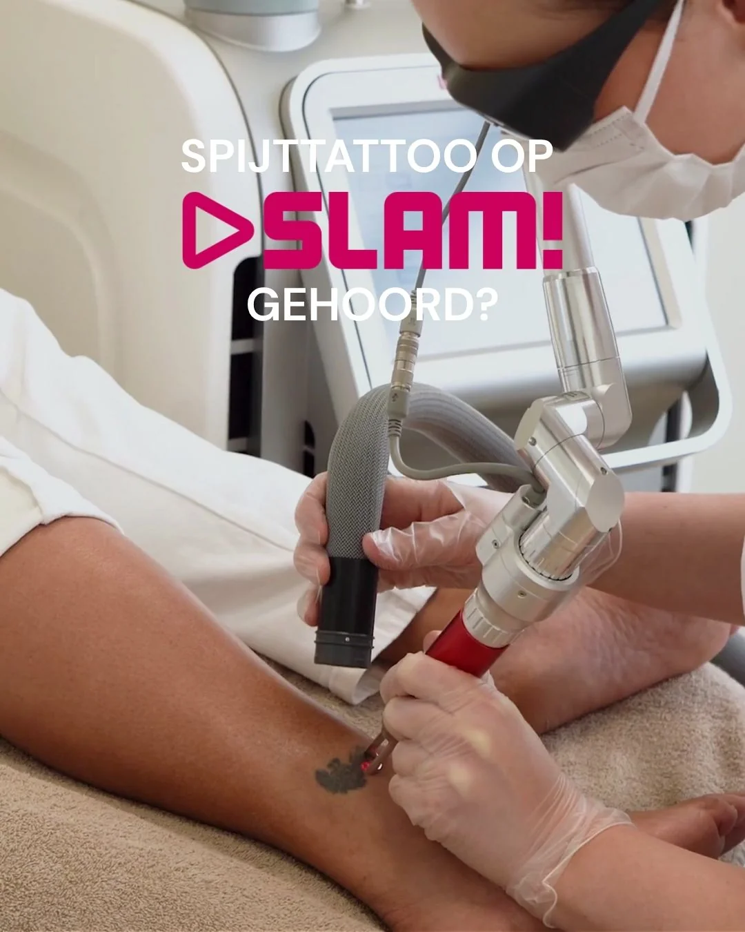 Laserbehandeling voor het verwijderen van een tattoo bij Cosmetique Totale