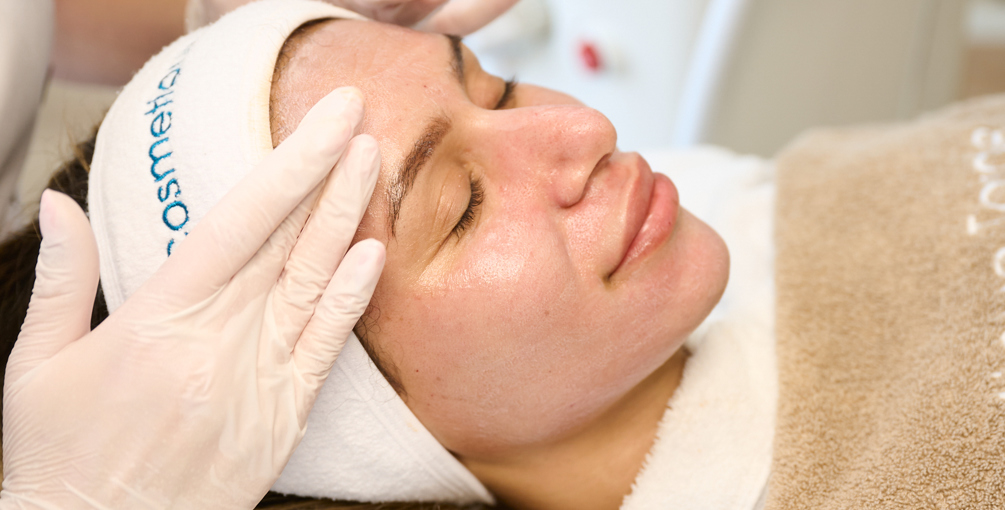 Microneedling Met Radiofrequentie Werkt Het Echt