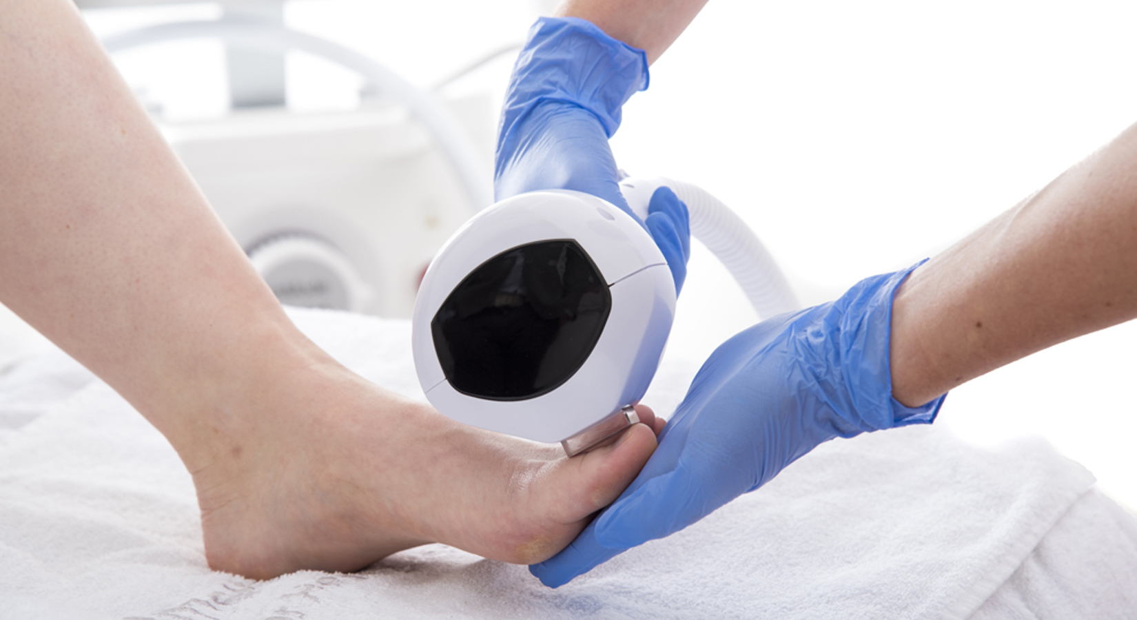 Header Schimmelnagels In De Zomer Wat Nu