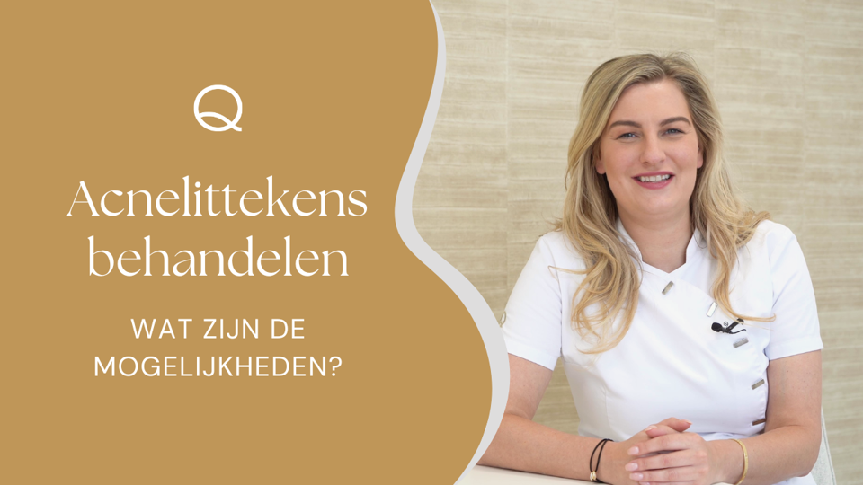 Acnelittekens Behandelen
