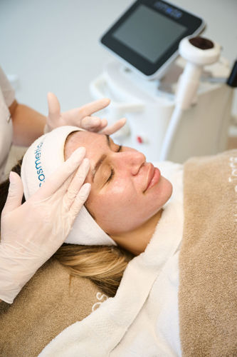 CT Special IPL En Peeling