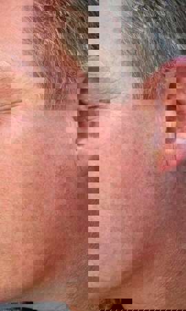 Ergebnis Nach
