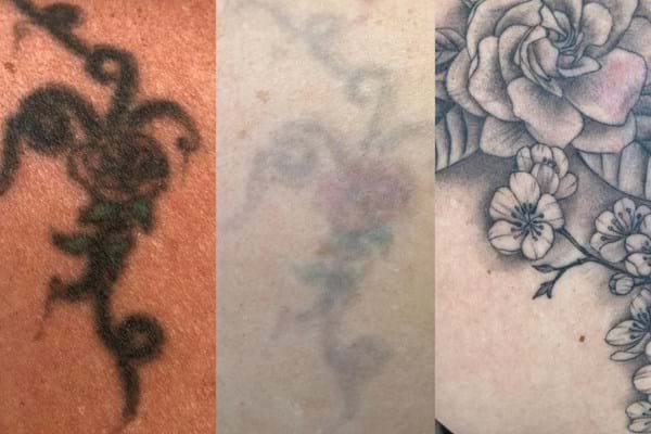 Tattoo Verlichten Cover Up