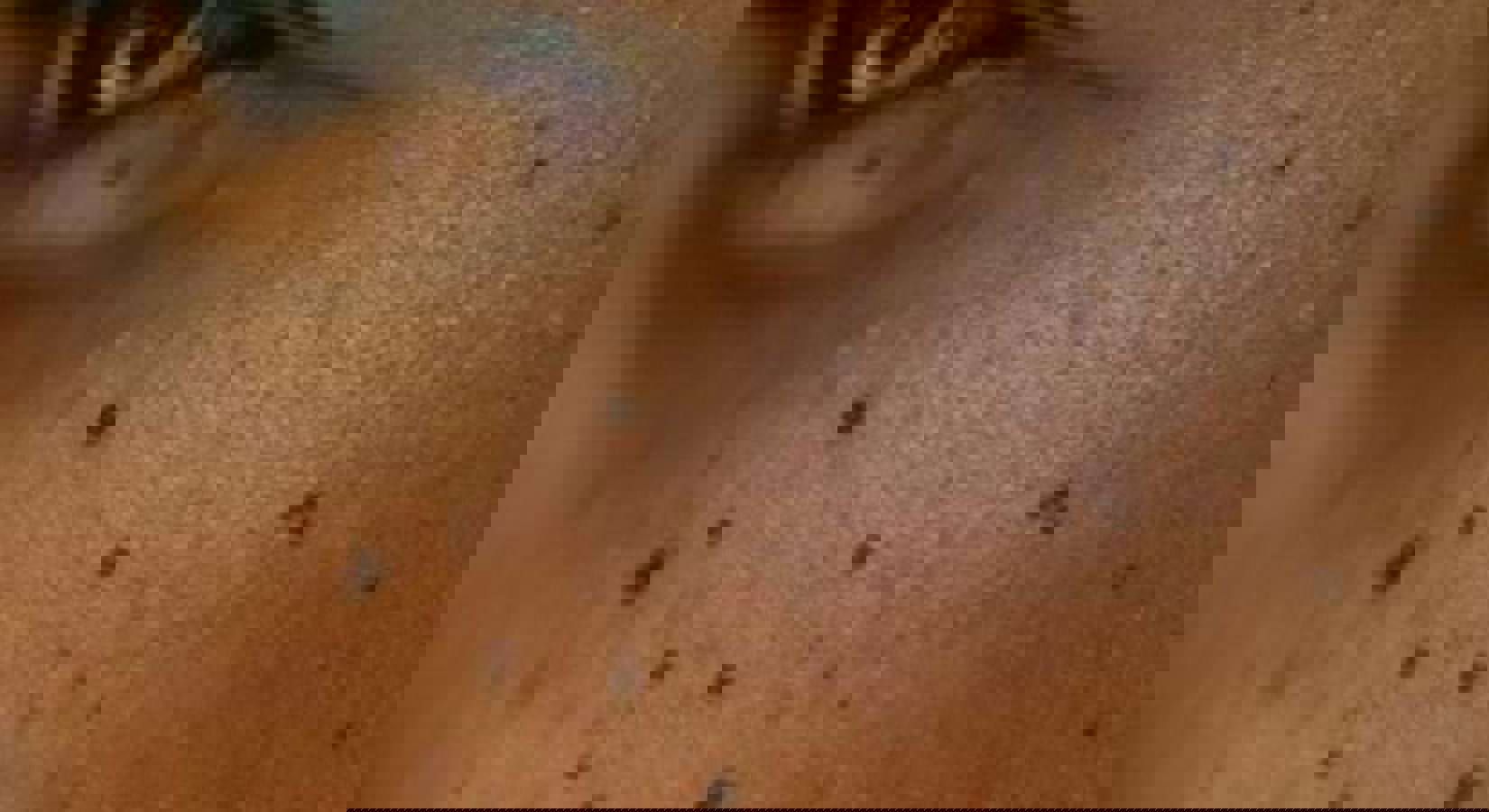 TACHES NOIRES SUR VOTRE VISAGE