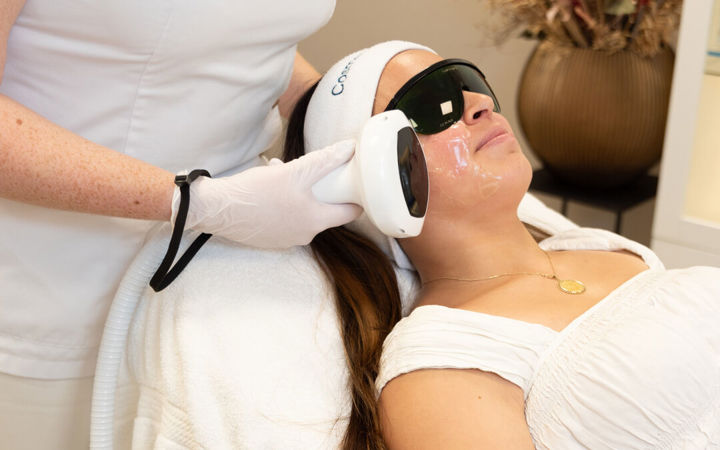 IPL-Behandlung von Pigmentflecken mit kühlendem Gel bei MyDerma in München