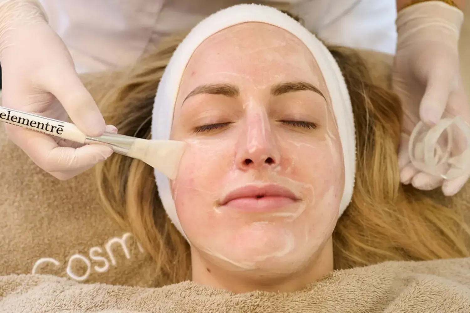 Aknebehandlung Peeling
