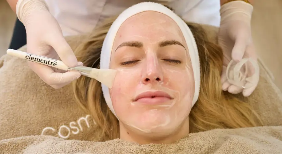 Aknebehandlung Peeling