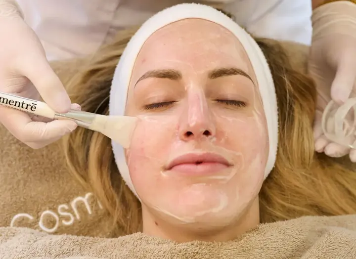 Peeling Tegen Pigmentvlekken