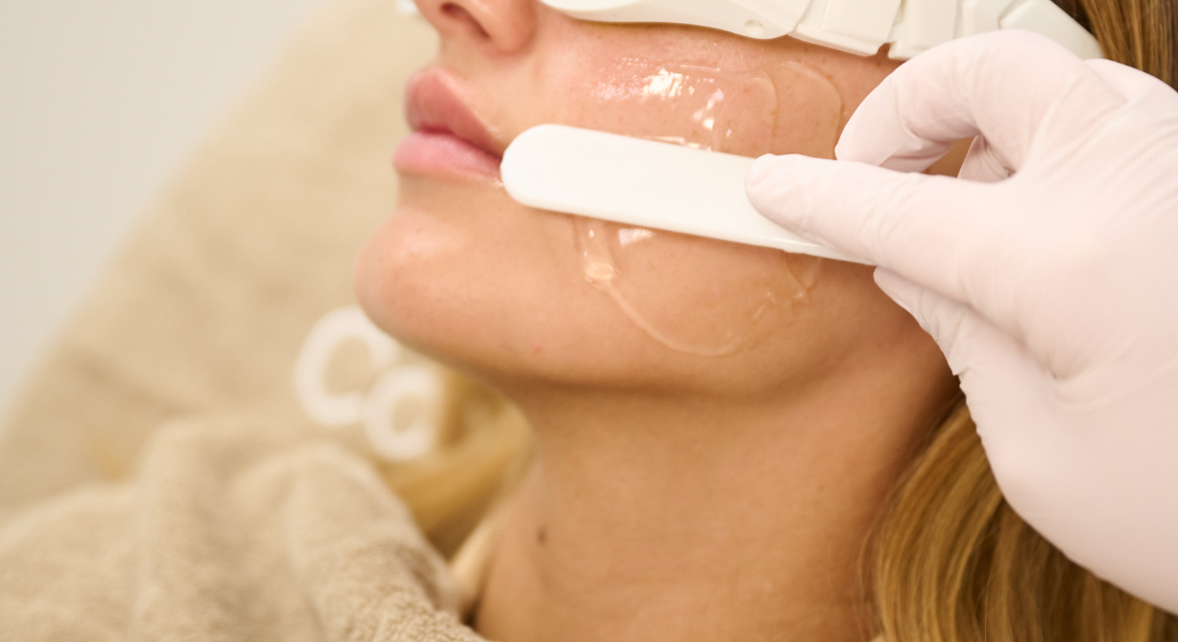 PCOS Behandlung Übermäßiger Haarwuchs