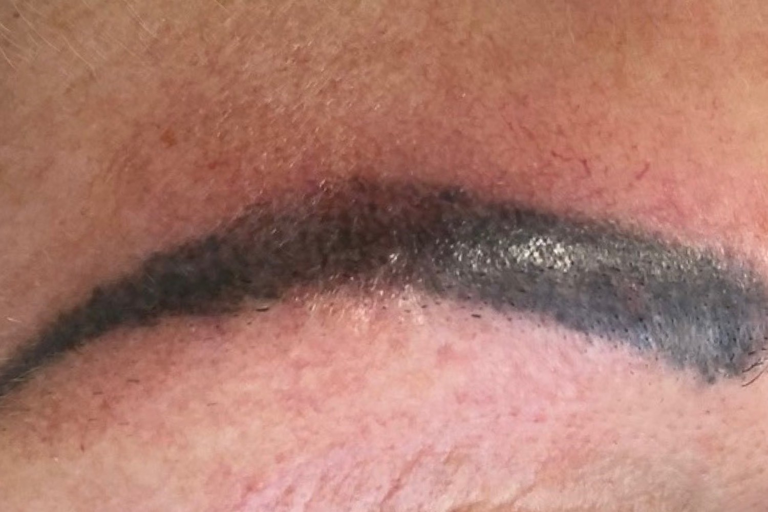 Permanente make-up verwijderen