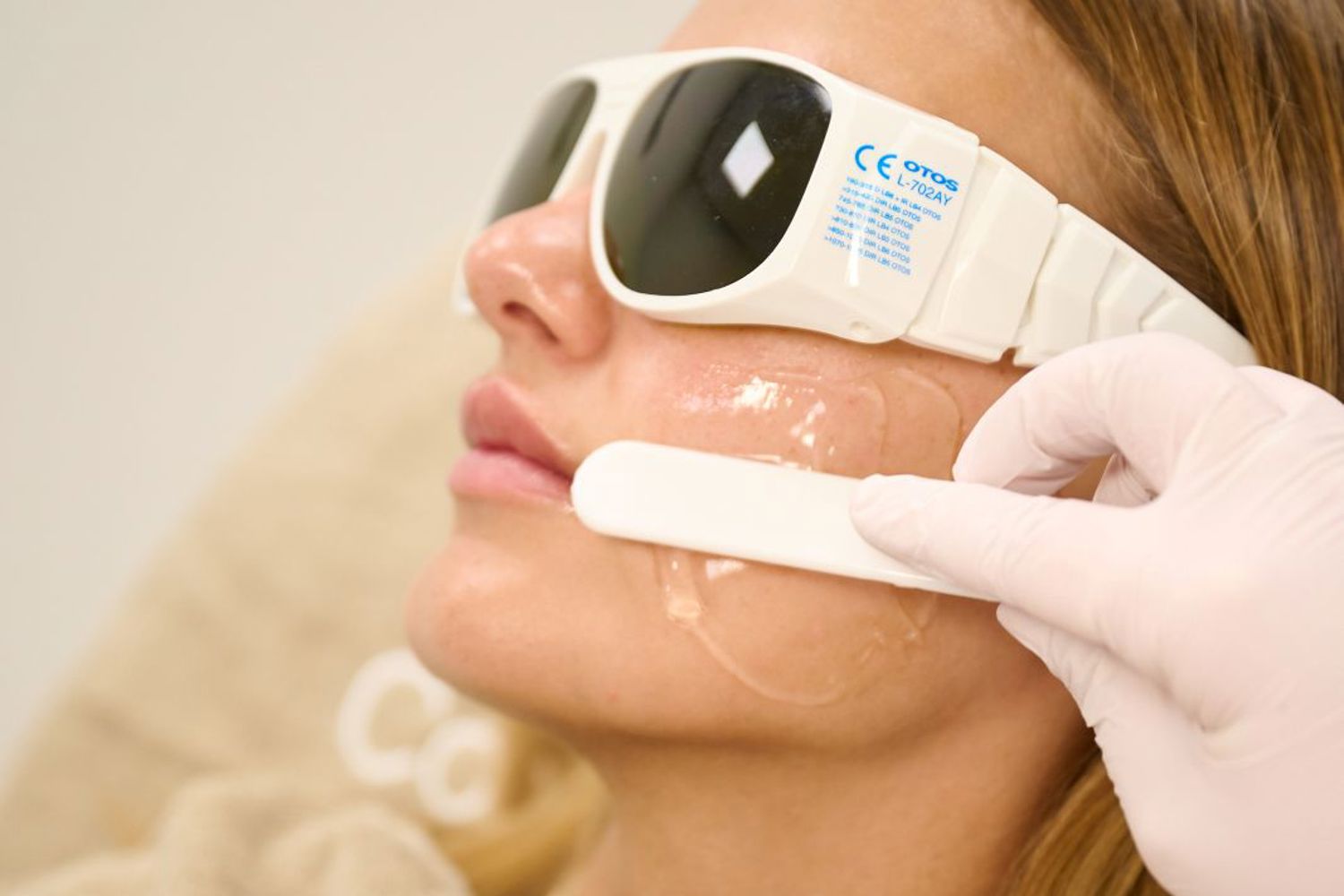 Gezichtshaar Laseren