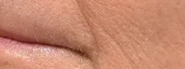 Morpheus Vorher1