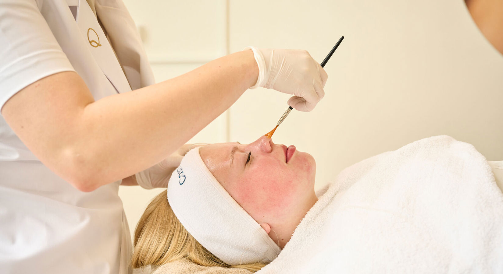 Rosacea Behandeling voor een rustige en egale huid