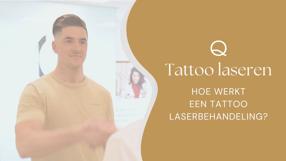 Hoe Werkt Tattoo Laseren