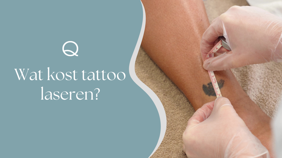 Wat Kost Tattoo Laseren (2)