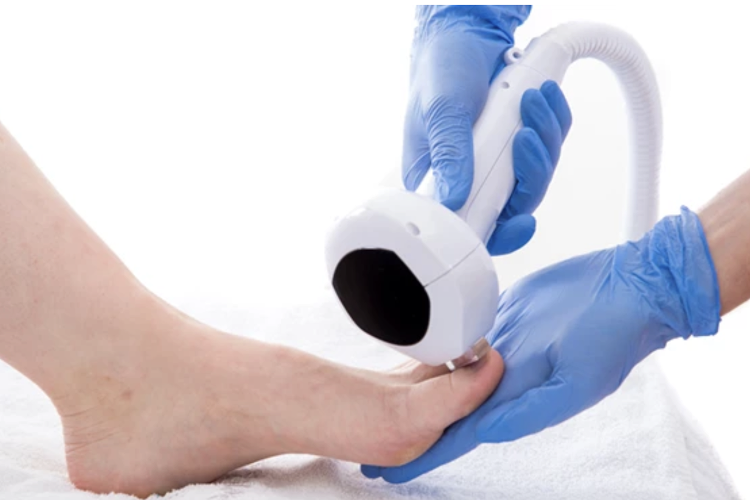 Traitement Des Ongles Mycosés