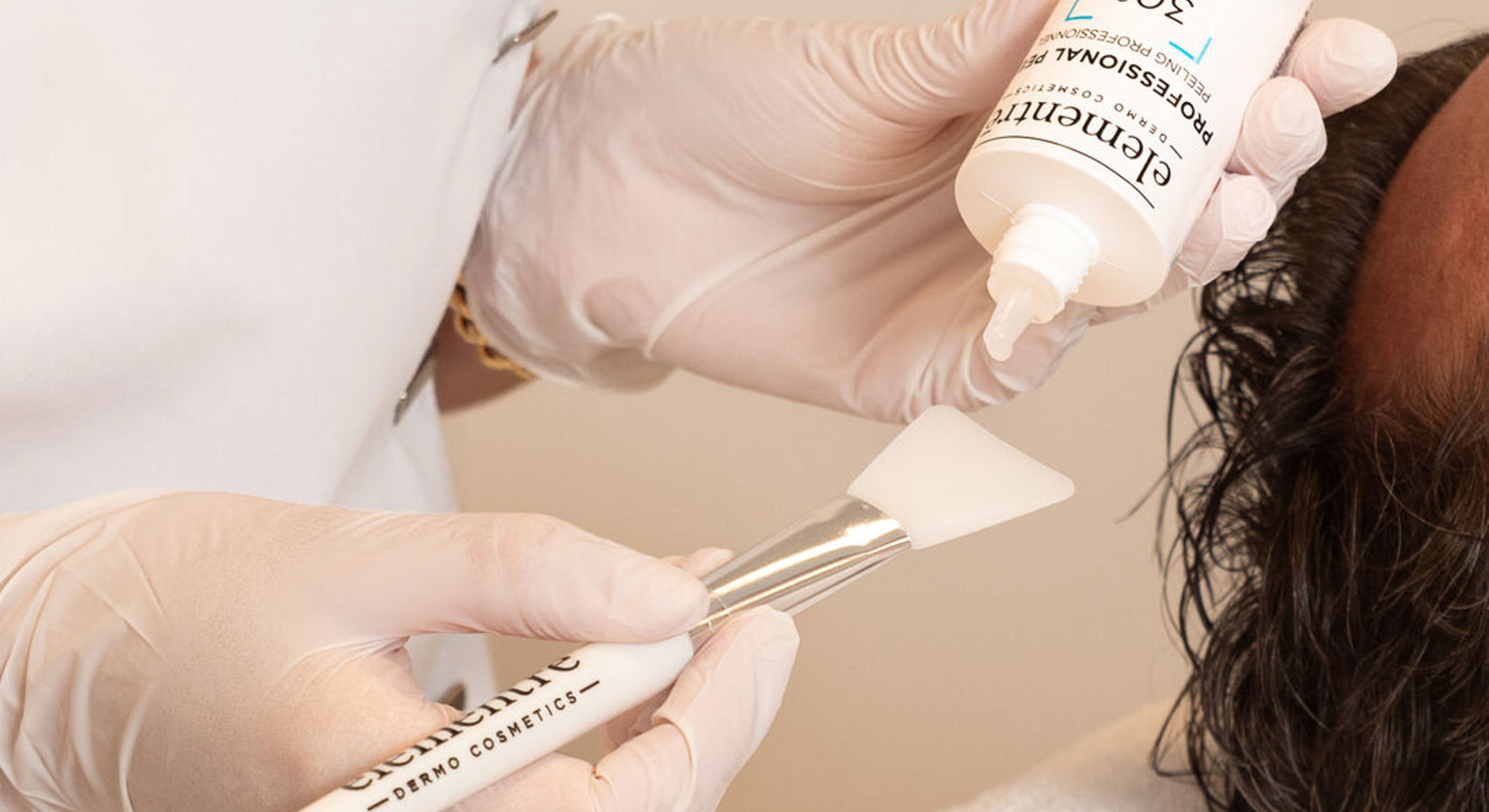 Ervaring Peeling Bij Cosmetique Totale