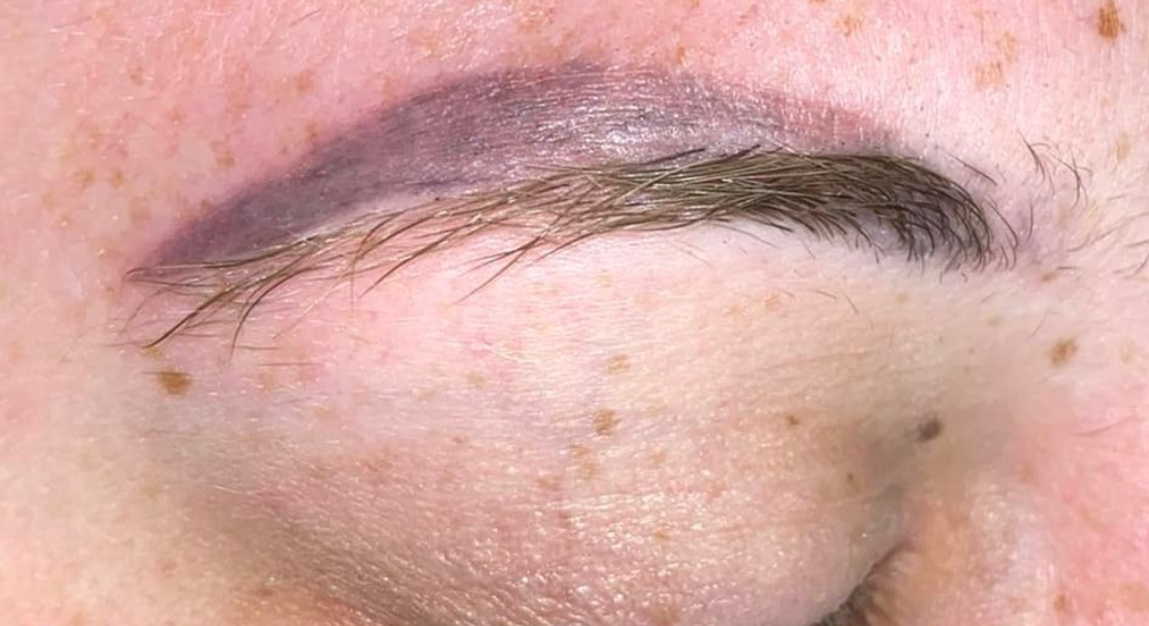 Spijt van je microblading of PMU