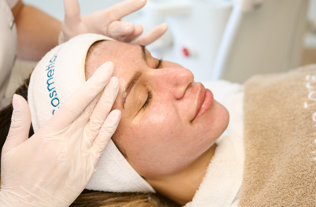 Microneedling behandeling van het gezicht door een huidexpert bij Cosmetique Totale Antwerpen