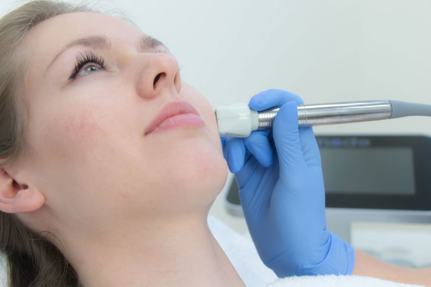 Laserbehandeling Rimpels Verminderen