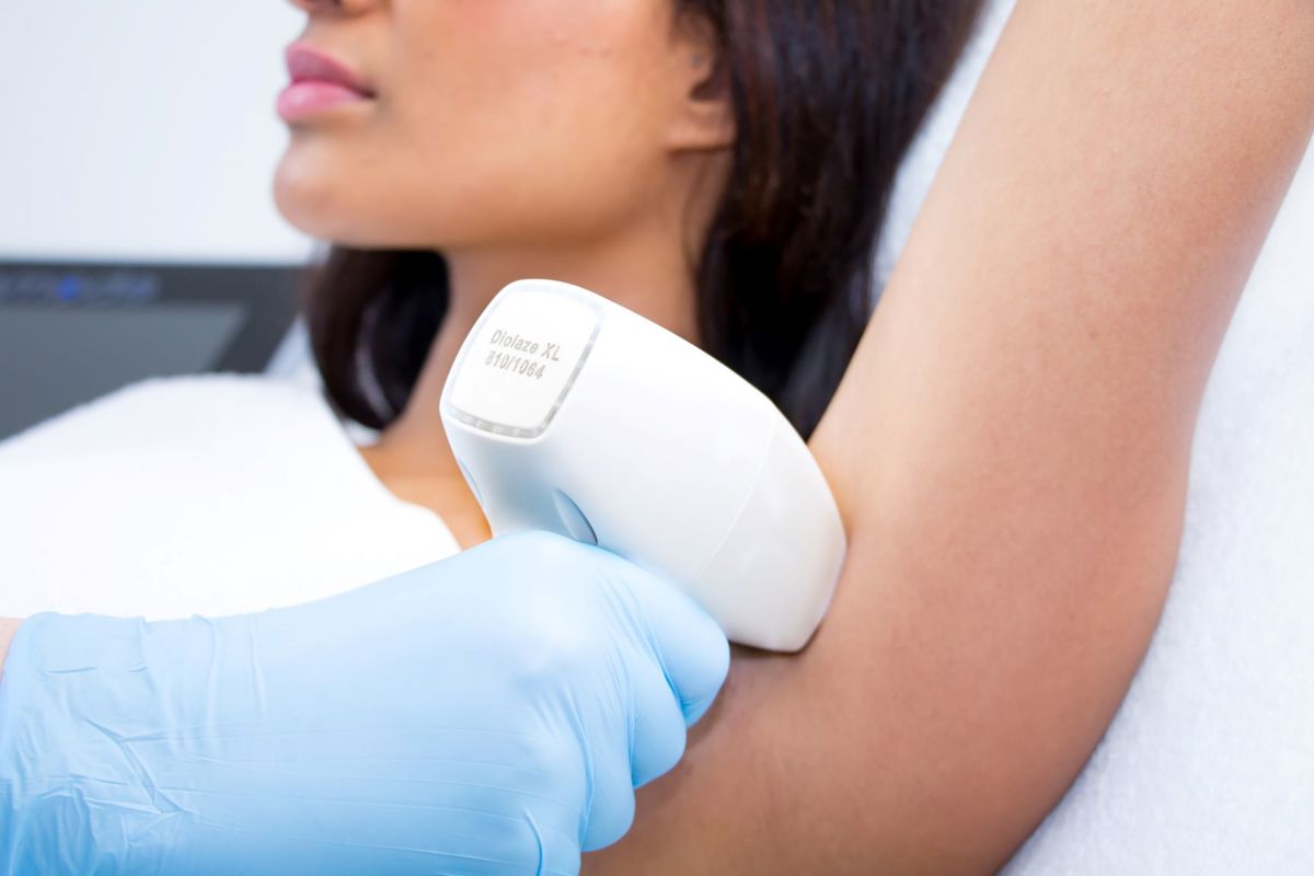 Laserontharing - Een Veilige, Permanente Ontharing - Bikinilijn laseren -ontharen bikinilijn -SoCleanClinic.be thumbnail