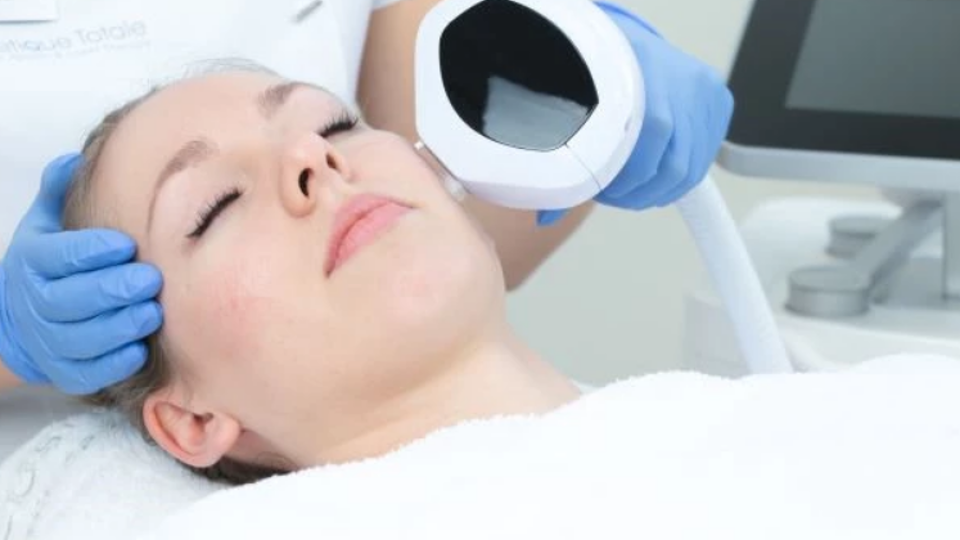 Laserbehandeling Pigmentvlekken België