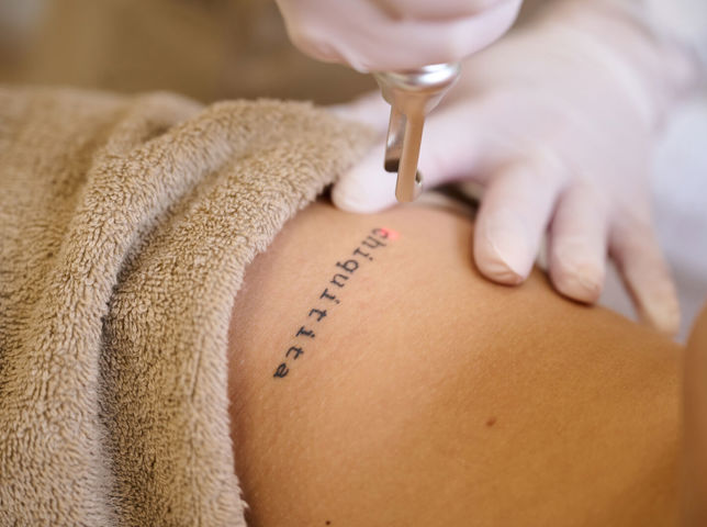 Tattoo verwijderen bij Cosmetique Totale