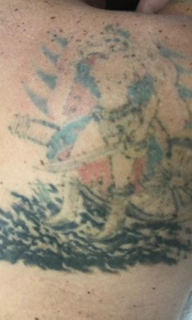 Tattoo 1X 2