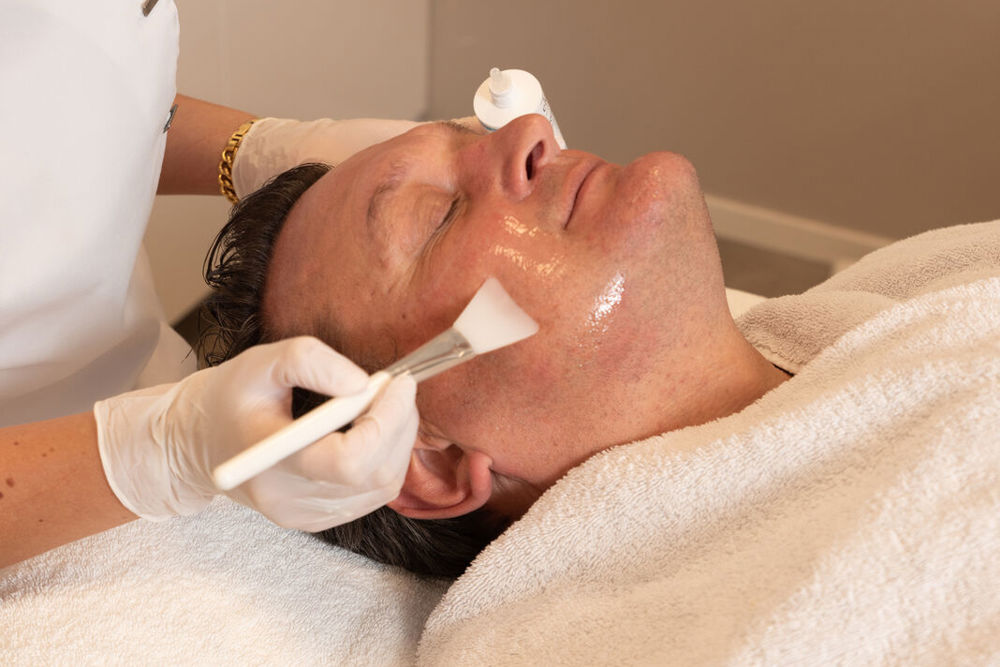 Hauttherapeutin trägt ein medizinisches Peeling gegen Pigmentflecken auf, Hautinstitut MyDerma in München