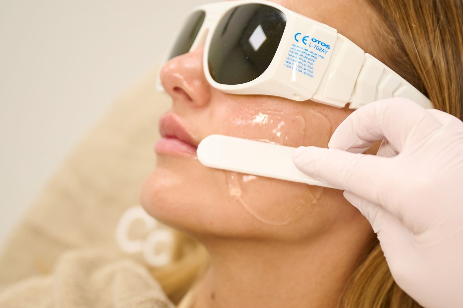 PCOS Behandeling Overbeharing (1)
