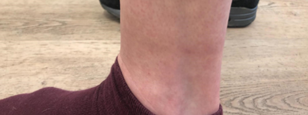 Tattoo 5X 2